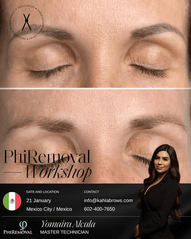 PhiRemoval (Curso presencial) / Ciudad de Mexico/ CDMX / Enero 21, 2027