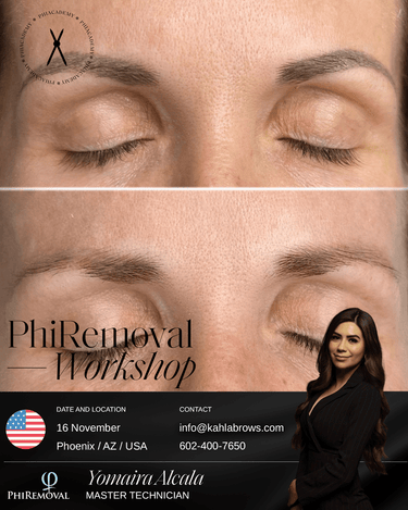 PhiRemoval (In-Person + Online Program) / Phoenix, AZ / November 16, 2026